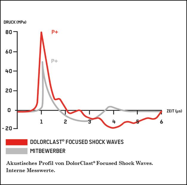 Akustisches Profil von DolorClast Focused Shock Waves